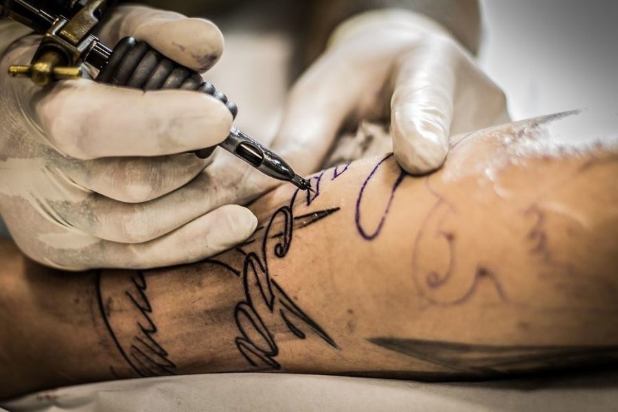 Rückstandslose Tattooentfernung in Düsseldorf